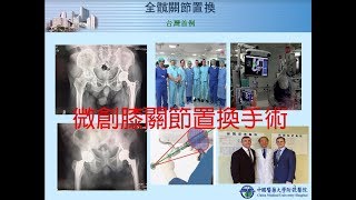 兩岸新聞台 :  微創機器人手臂問世　開啟骨科手術新紀元