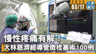 慢性疼痛有解！大林慈濟經導管微栓塞術100例｜大愛新聞   @DaaiWorldNews