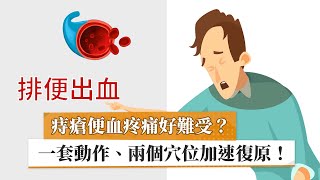 【章晉瑋醫師】痔瘡便血疼痛好難受？　一套動作、兩個穴位加速復原！｜健康醫療網