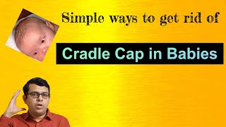 Cradle Cap in Babies | What is it ? | Simple ways to get rid of Cradle Cap
