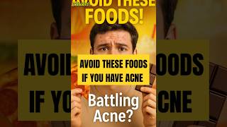 Avoid these foods if you have acne! #healthtips #acne