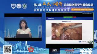 手術視頻轉播｜劉潔教授－卵巢癌MIS MDT