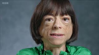 Better Off Dead? - Liz Carr's documentary on assisted suicide