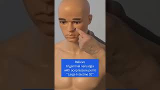 #TrigeminalNeuralgia - Acupressure in 60 Seconds