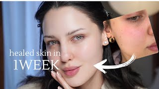 How I healed my skin barrier in * 1 WEEK* | Korean Product Recs