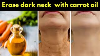 Carrot Oil Removed My Skin Tags & Dark Neck? The Shocking Result!