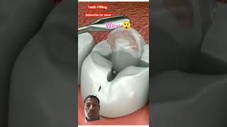 #dentist #teeths #beauty #childteeth #