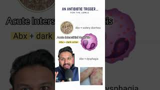 Antibiotic Trigger for the USMLE | HyGuru