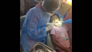 pulpectomy for children's  #oralhealth #dentist #childteeth