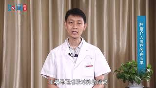 【普通外科】肝癌介入治疗的存活率
