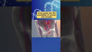 人体微循环是百病之源? (EN subtitle) Microcirculation is the root cause of all diseases? #healtheducation