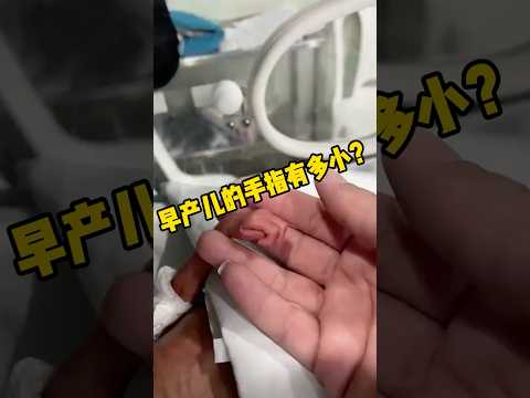 早产儿的手臂原来这么小 #科普 #早产儿 #婴儿