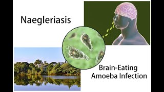 Naegleria fowleri(Brain-eating bacteria).Top 5 Symptoms,Causes and How do you Prevent it.