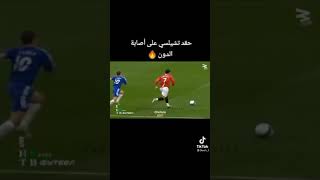 أصابة كرستيانو رونالدو مع مانشستر يونايتد