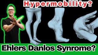 Ehlers Danlos Syndrome [Hypermobility, Symptoms, Diagnosis & Test]