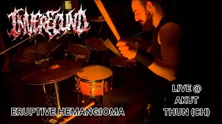 Alessandro Cupici - Inverecund - Eruptive Hemangioma (live drum cam)