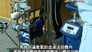 20140418 公視手語新聞 葉克膜兩千例 台大救活六百多人
