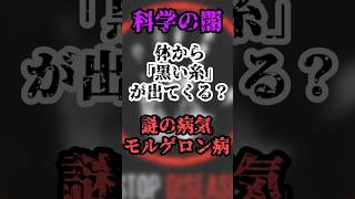 【恐怖】体から黒い糸が…？謎の奇病“モルゲロン病”の正体とは #科学 #怖い話 #奇病 #shorts