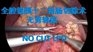【有声扯淡版】全腔镜下胰十二指肠切除术Laparoscopic pancreatoduodenectomy
