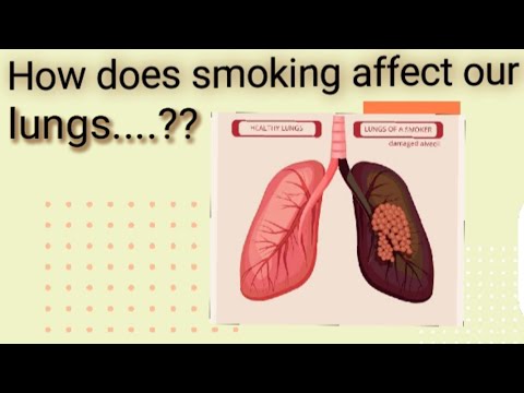 Harmful effects of smoking....#quitsmoking #effectsofsmoking