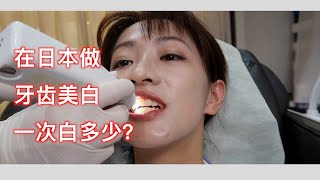 日本牙齒美白技術保證一次美白5個度是真的嗎？