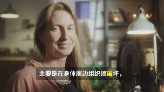 重新思考阿尔茨海默病：全身影响的新发现 2025 06 04