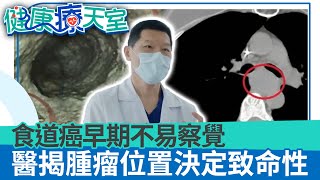 食道癌存活率高嗎？ 早期不易察覺 醫揭腫瘤位置決定致命性《健康療天室精華篇》胸腔外科 施志勳 @health.chatbox​