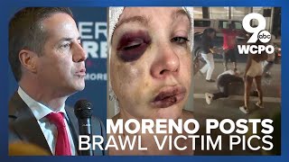 Bernie Moreno calls out Cincinnati leaders after 'violent attack'