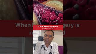 Bypass Surgery