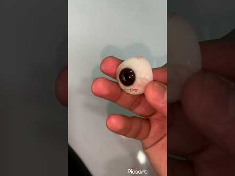 Tailor made artificial eye #artificialeye #bangalore #losteyetreatment #prostheticeye
