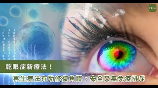 乾眼症新療法！PRP療法有助修復角膜，安全又無免疫排斥｜Heho Topics