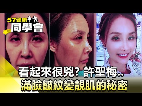 看起來很兇？許聖梅  滿臉皺紋變靚肌的秘密【@57healthy 】2024.12.07｜張予馨 、鄒玉樹、莫芳、莊斯棋、許聖梅