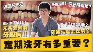 【牙齒保健 #12】洗牙是什麼？洗牙有辦法把茶垢及咖啡垢完全清除嗎？為什麼牙菌斑跟牙結石會愈來愈多？｜【祐民牙醫－隱適美旗艦店】許四融醫師 ( 小許醫師 ) #洗牙 #牙菌斑 #牙結石 #祐民牙醫