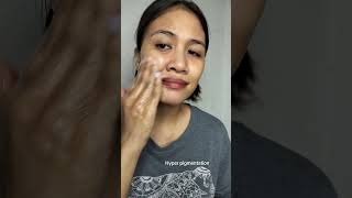 Magic Spell Premium Kojic Niacinamide Soap Review #Magicspellsoap #kojicniacinamidesoap #skincare