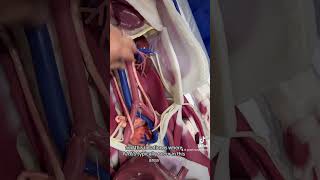 Where abdominal aortic aneurysms occur? #paramedic #emt #ems #paramedicstudent #paramediclife