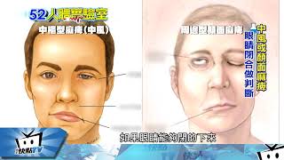 20171204中天新聞　人體實驗室　臉歪嘴斜流口水　顏面神經麻痺了
