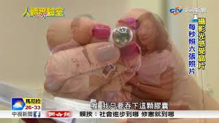 人體實驗室 膠囊內視鏡看小腸病變│中視新聞 20171007