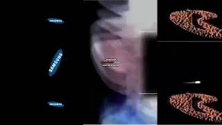 16 SCAN (Gheorghe Voda's shuric scan fast stuff part 4 Version)