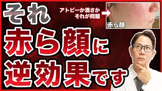【赤ら顔】まずは酒さかアトピー性皮膚炎かの見極めが重要です