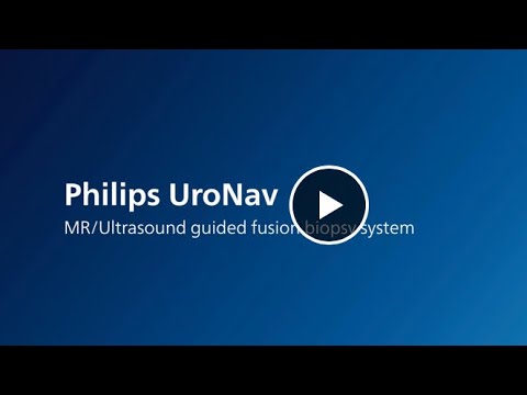 𝗣𝗵𝗶𝗹𝗶𝗽𝘀 𝗨𝗿𝗼𝗡𝗮𝘃- an MR/ultrasound guided fusion biopsy system- Prostatecare