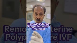 Removing Uterine Polyps Before IVF Treatment