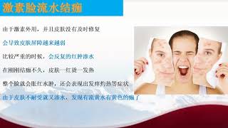 缓解激素脸面部流水结痂(181)