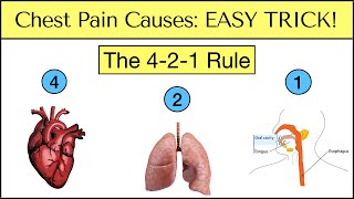 Causes of Chest Pain: EASY TRICK to Never Miss an Emergency [Must See]