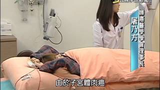 20150304 公視手語新聞 子宮體肉癌難發現 晚期存活率低