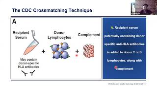A SIMPLE GUIDE TOWARDS UNDERSTANDING PRE TRANSPLANT CROSS  MATCH