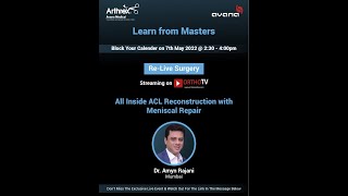 ReLive Surgery - Arthroscopic Assisted ACL Reconstruction - Dr Amyn Rajani