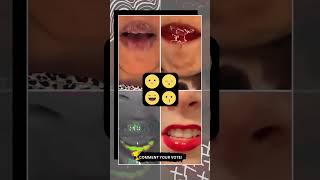 🏆 CEO OF TREND #0056 #shorts #ytshorts #lips