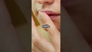 Stop nail-biting#Shorts #HabitHacks #BetterEveryDay #DailyUpgrade #MindsetShift