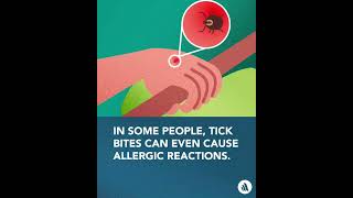 Diseases Spread By Ticks | Merck Manual Consumer Version