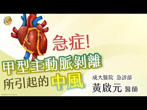 【成大醫院】成大e學堂【甲型主動脈剝離所引起的中風】急診部 黃啟元醫師